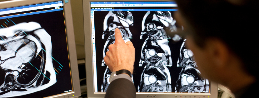 A doctor showing x-ray scans on a screen
