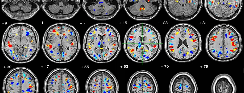 Brain scans