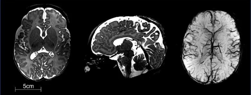 Brain scan images