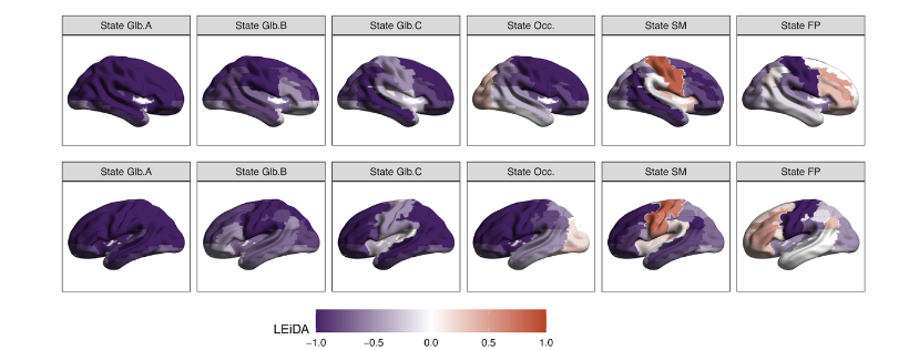 Brain scans