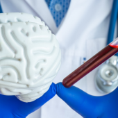 A doctor in a white coat holds a brain model and a vial of blood, wearing blue gloves