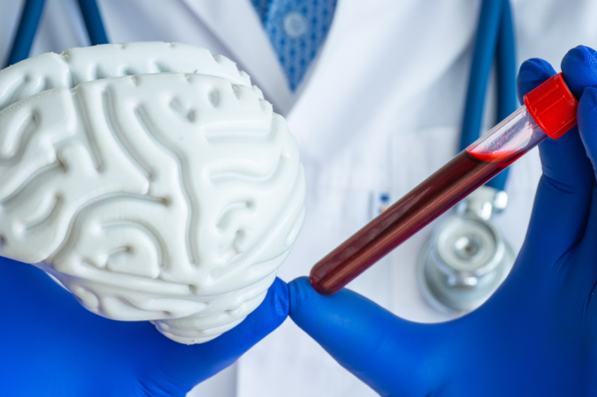 A doctor in a white coat holds a brain model and a vial of blood, wearing blue gloves