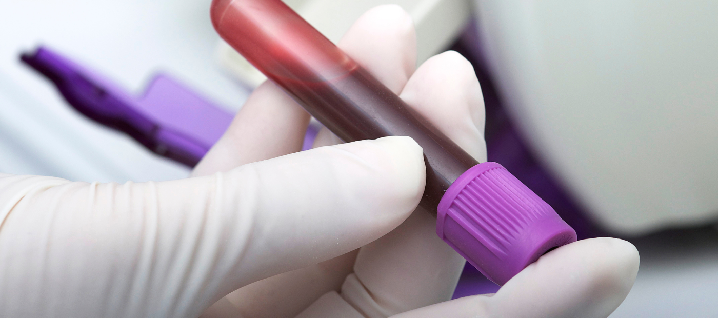 Diagnosis of a genetic cause in hundreds of people with motor neuron disease could be missed due to “arbitrary age limits and rules” on genetic testing, new study shows