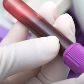 A gloved hand holds a blood sample in a test tube with a purple cap