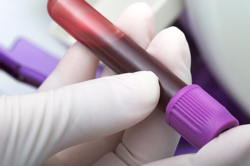 A gloved hand holds a blood sample in a test tube with a purple cap