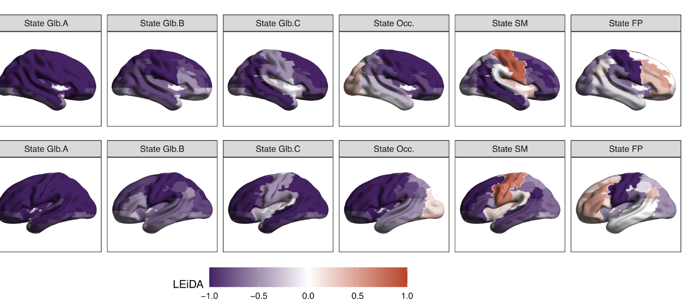 Patterns of brain connectivity differ between pre-term and term babies