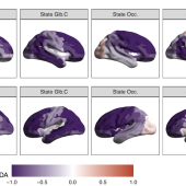 Two rows of brain images in various states show LEiDA analysis with color gradients from purple to red, representing values from -1.0 to 1.0.