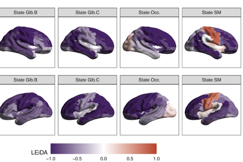Two rows of brain images in various states show LEiDA analysis with color gradients from purple to red, representing values from -1.0 to 1.0.
