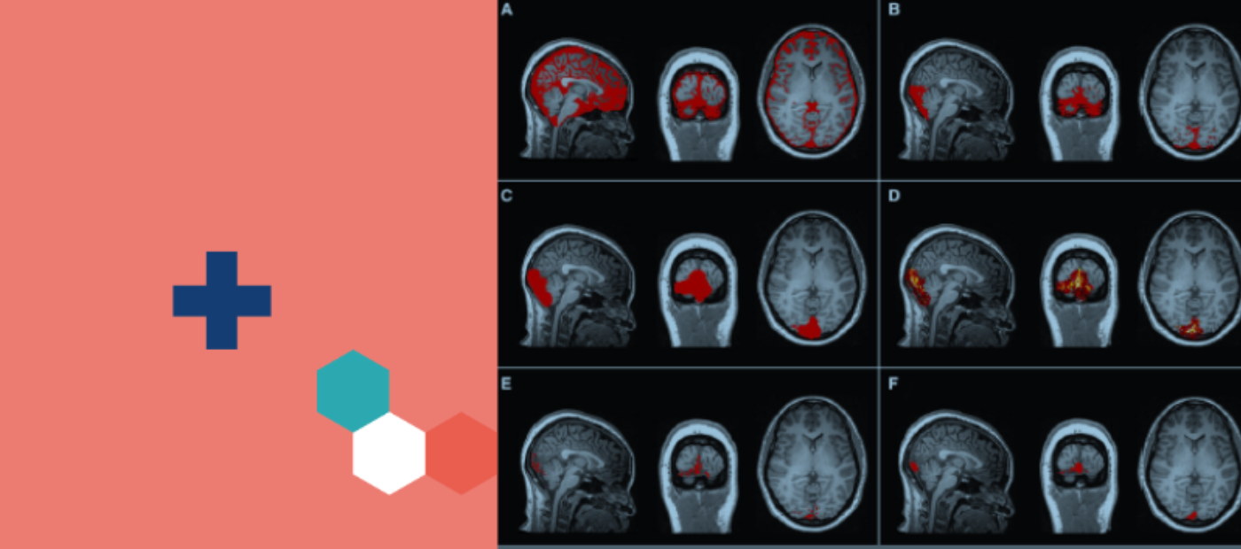 “Missing link” between brain and body inflammatory signals identified in the skull