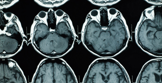 Low-cost and portable imaging
