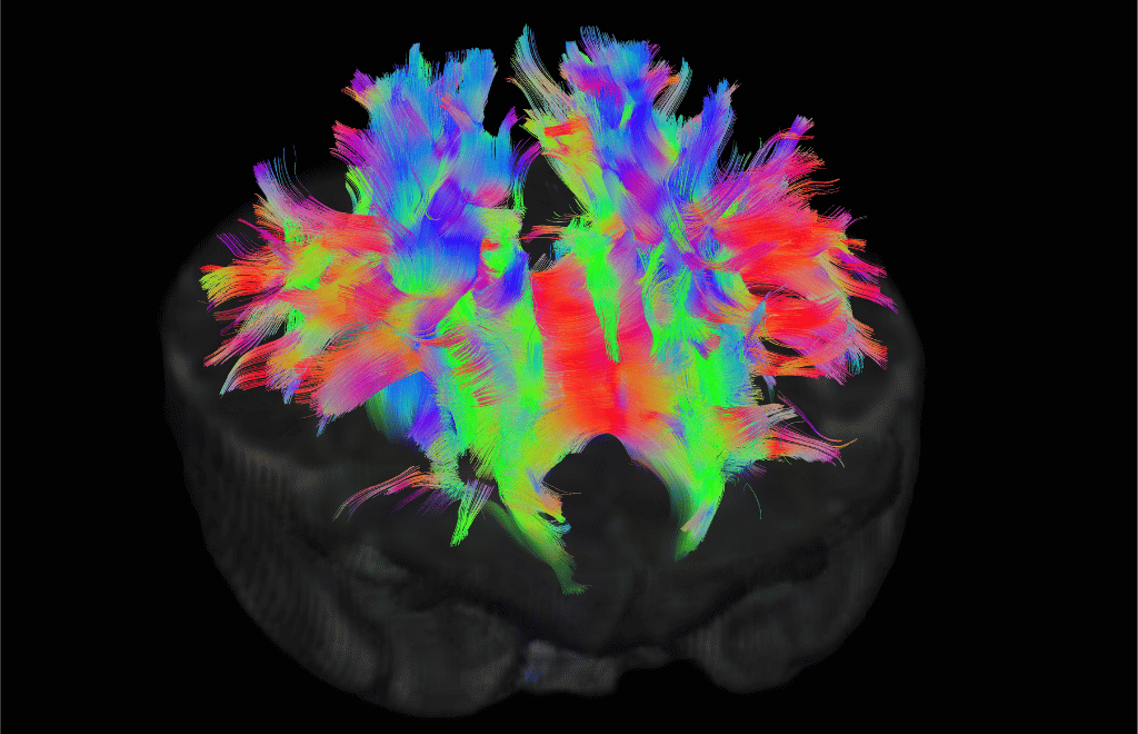 structural connectivity in a neonatal brain