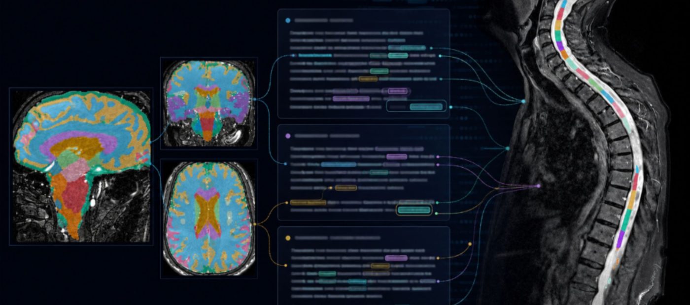 Wellcome-funded DreaMS project aims to advance personalised care in multiple sclerosis 