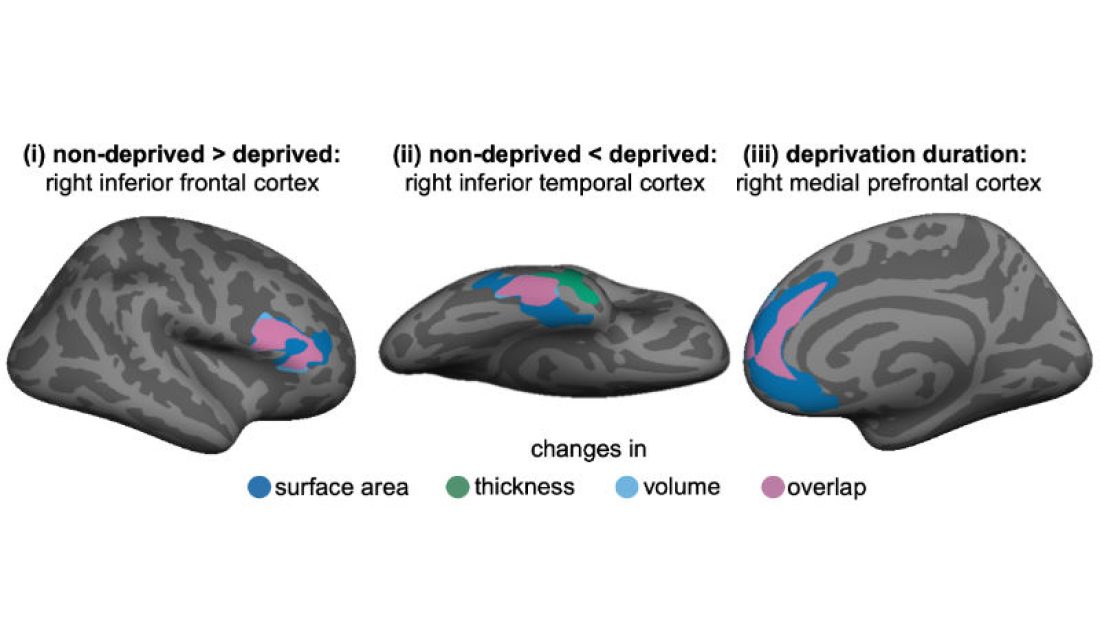 Fig2-regional-brain-maps.x806c09b1